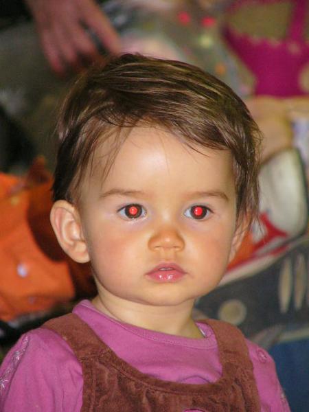 Yeux rouges